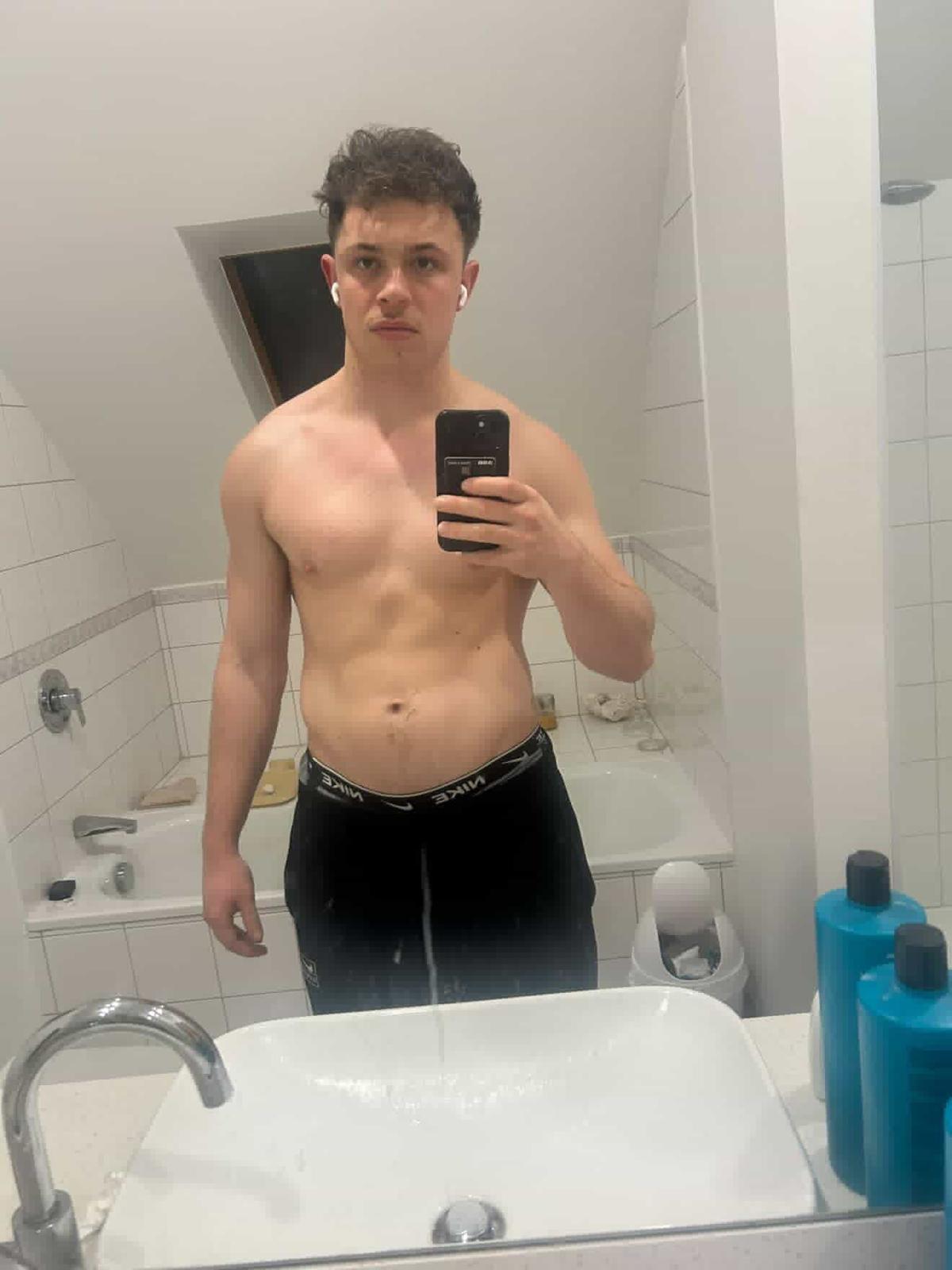 Before — starting point